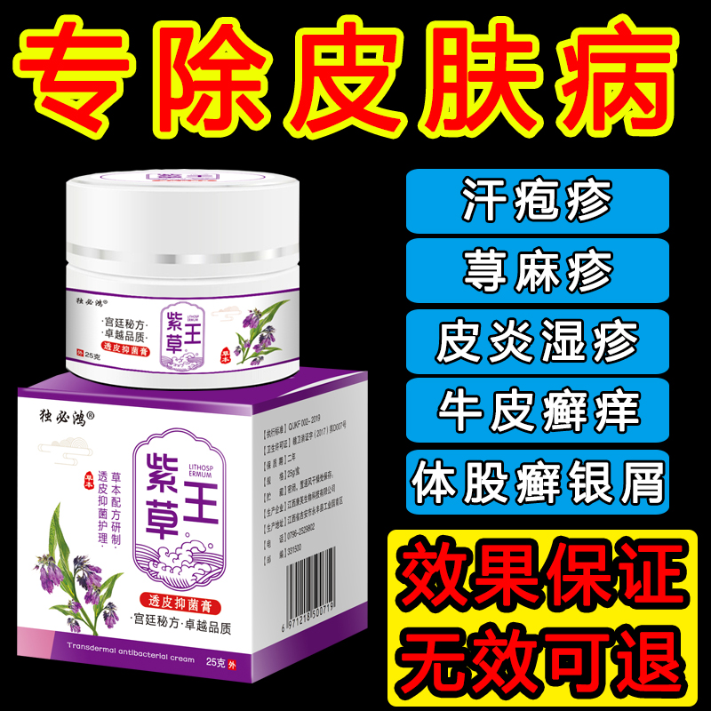 牛皮藓皮肤外用治疗屑手足藓皮肤瘙痒头止痒去湿根疹股体藓特效膏-图1