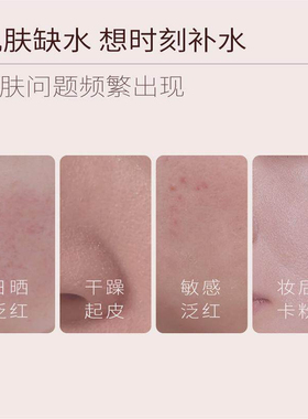 半亩花田玫瑰花水补水保湿喷雾爽肤水护肤水秋冬湿敷面部干燥护理