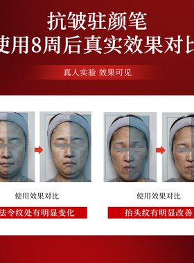Euglena抗皱微针精华法令纹神器鱼尾纹川字纹抬头纹
