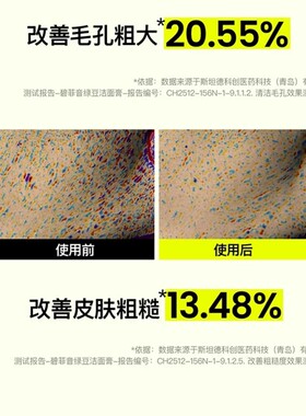 韩国beplain绿豆洗面奶氨基酸敏感肌温和控油卸妆洁面清毛孔80ml