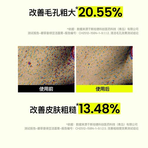 韩国beplain绿豆洗面奶氨基酸敏感肌温和控油卸妆洁面清毛孔80ml - 图1