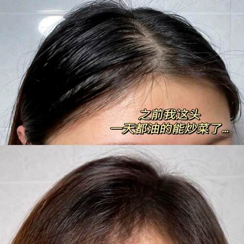 Hair Recipe发之食谱无花果洗发水护发素去控油蓬松洗头膏男女士 - 图0