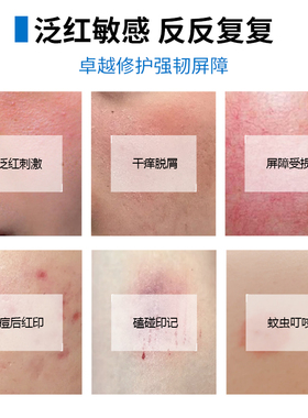 芭诗丽多效修护凝胶点痣点斑后修护舒缓泛红淡化印痕肌肤屏障修护