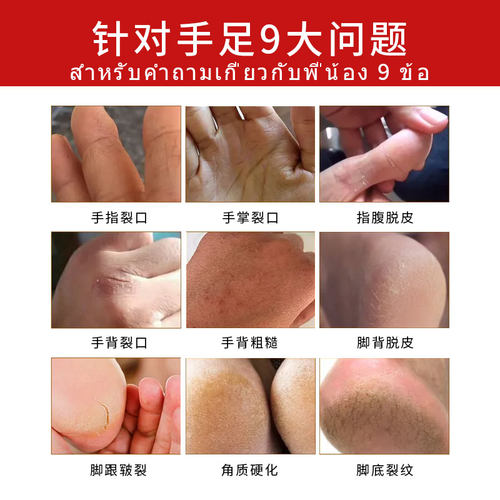 泰国vincere珍珠香蕉膏滋润手脚干燥手足粗糙修复滋润护理膏 - 图0