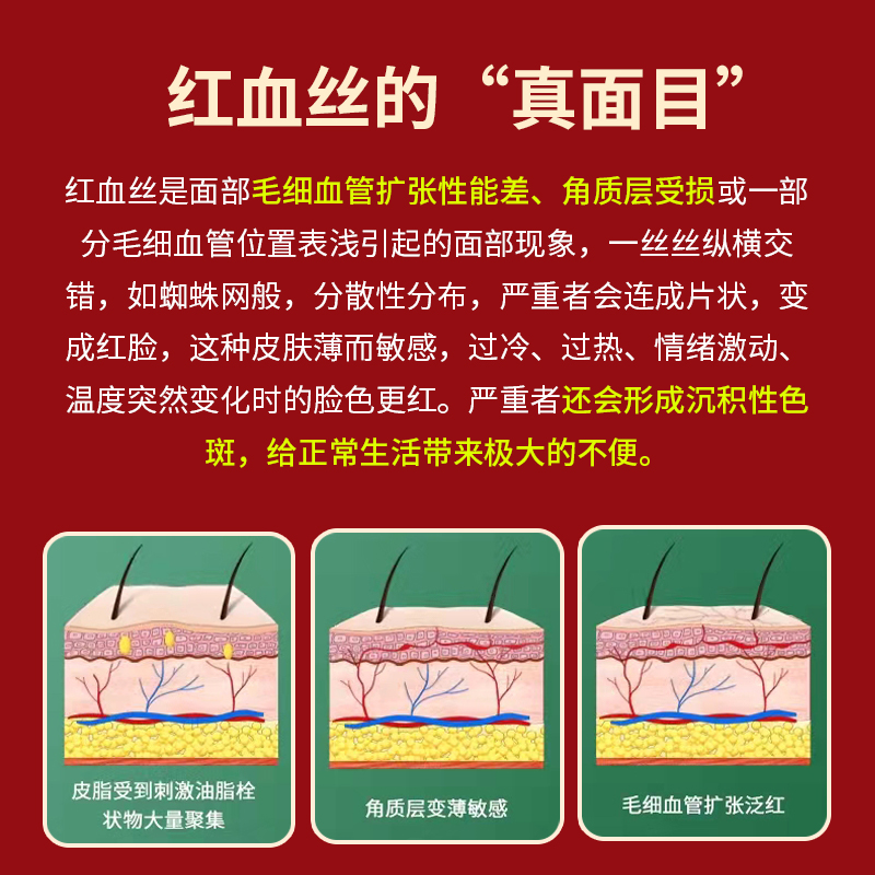 过敏皮肤修i复脸部医用去红血丝膏药敏感肌泛红痒肿男女士干燥皮 - 图2