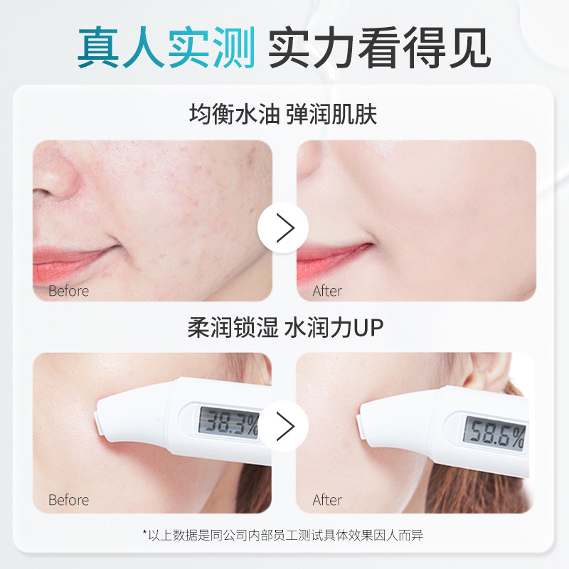 荣晟透明质酸保湿舒缓镇定柔肤水 荣晟个人护理化妆水/爽肤水