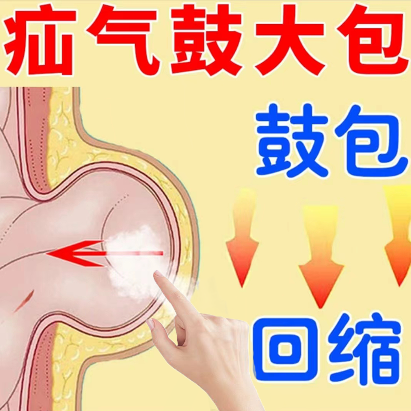 疝气贴腹股沟中老年专用疝气治疗带婴儿凸肚脐特效膏药正品旗舰店-图0