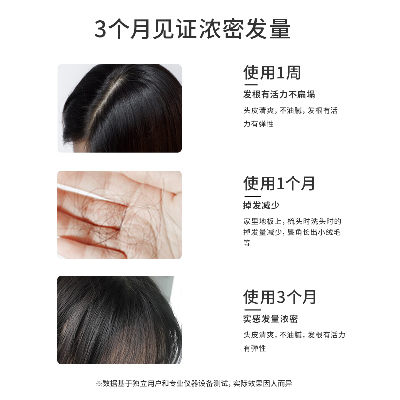 Newmo头皮营养头发护理发际线液增发掉精华护发精油调理掉发2瓶装