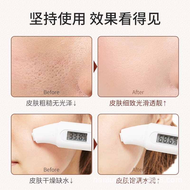 屈臣氏韩伦美羽玻尿酸补水精华液 爱恩爱液态精华