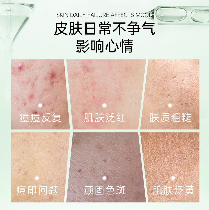 竹夫人美白淡面部温和保湿朱精华液 竹夫人液态精华