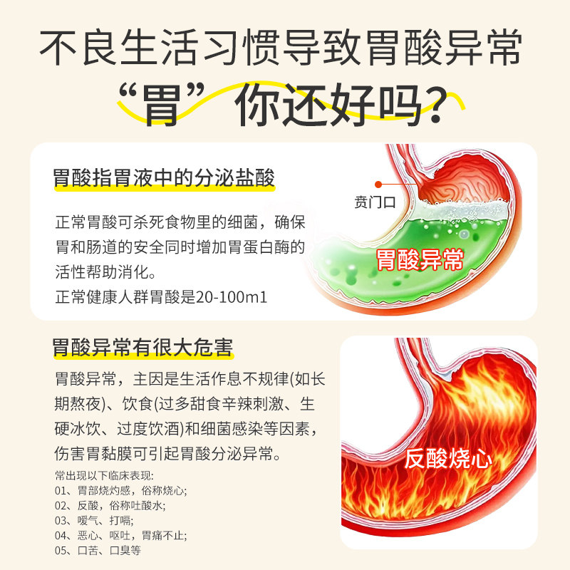 修正斯达舒胶囊胃药维U颠茄铝胶囊胃酸胃痛反酸慢性胃炎消化不良