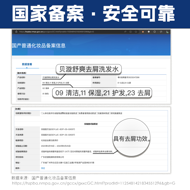 2盒贝扬贝漩发舒爽旗舰店专利去屑止痒控油洗发水改善大块头屑 - 图1