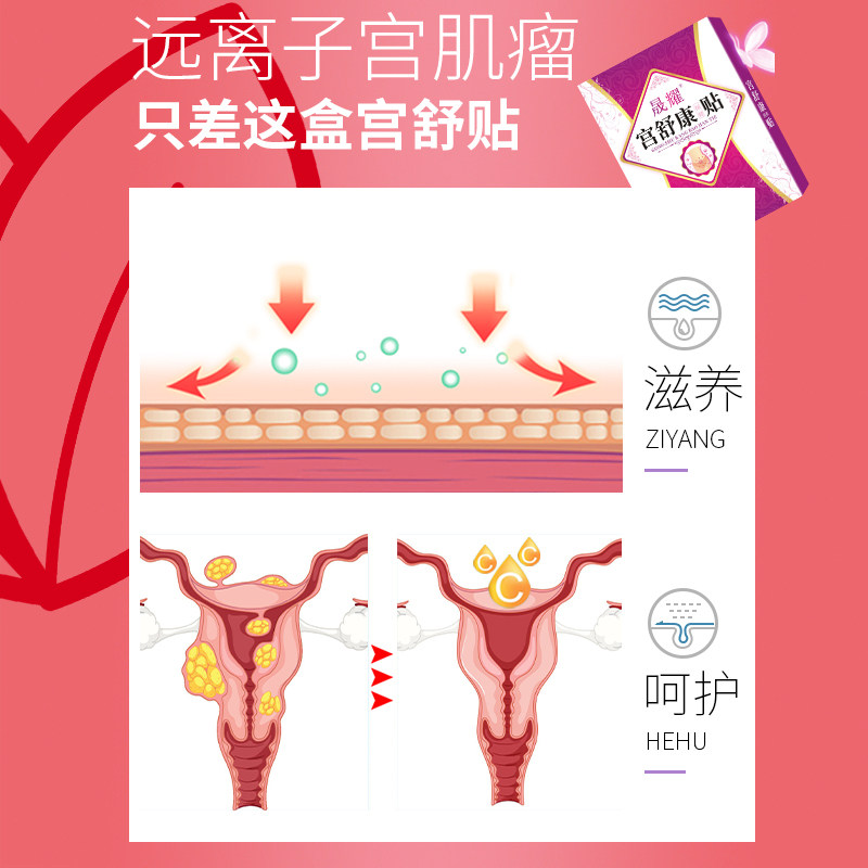 子宫肌瘤痛经暖宫膏贴 晟耀膏药贴（器械）