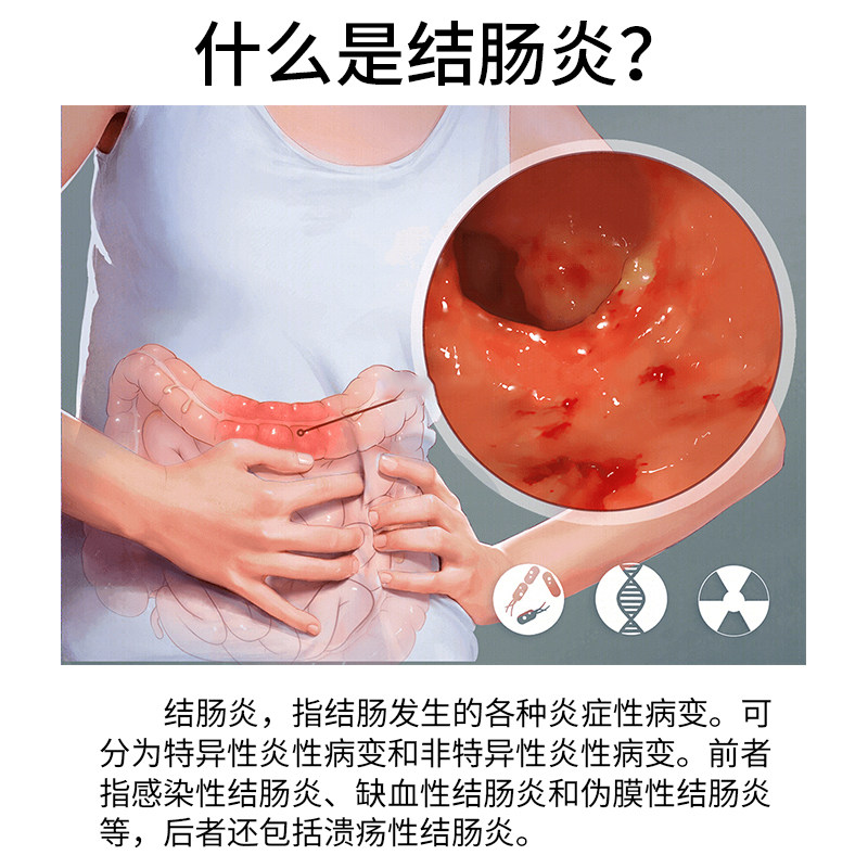 肚脐贴急慢性肠炎腹痛拉肚子药贴 晟耀膏药贴（器械）