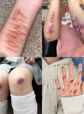 淤青纹身贴病态疤痕仿真脸部贴纸