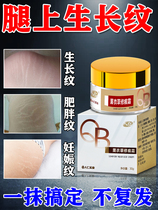 Go to obese vein growth ripples repair cream eliminates thigh student waist-abdominal upper fat veins remove male and female generic ointment