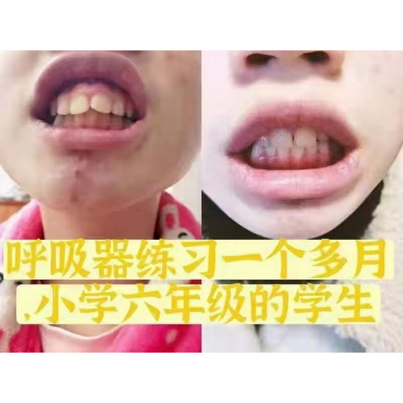 深呼吸儿童呼吸器瑜伽口呼吸矫正唇肌训练器打鼾排痰肺活量锻炼器-图0