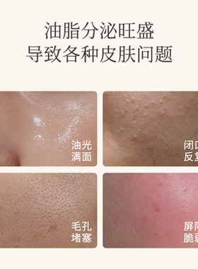植迷荟龙血树控油舒缓精华乳