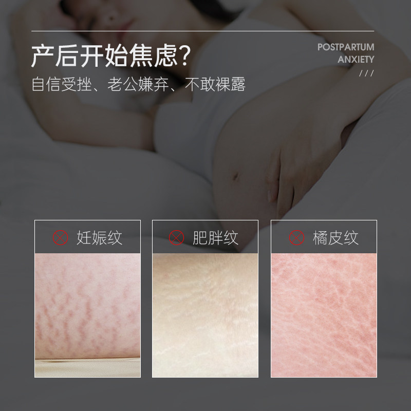 sdx焕颜滋养妊娠妊辰纹霜修护霜 sdx身体乳/霜