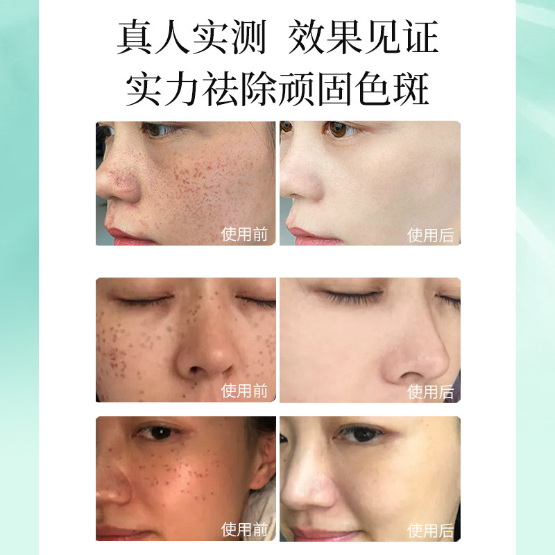 美白祛黄褐斑淡化色斑男护肤祛斑霜 珀泉肌蜜乳液/面霜