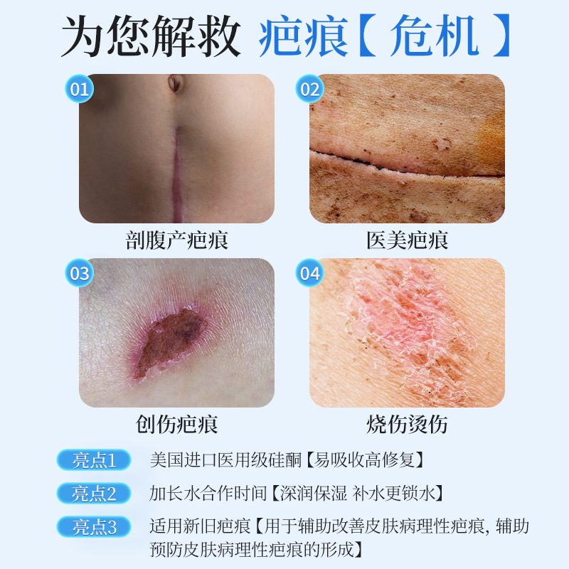 疤克医用硅酮凝胶原蛋白剖腹产祛疤膏母婴儿童烫伤增生凸起专用