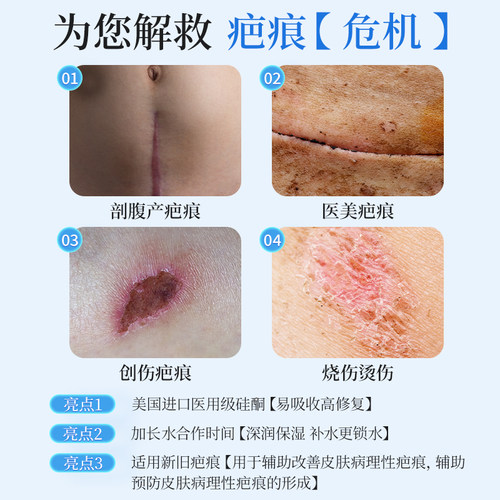 疤克医用硅酮凝胶原蛋白剖腹产祛疤膏母婴儿童烫伤增生凸起专用 - 图0