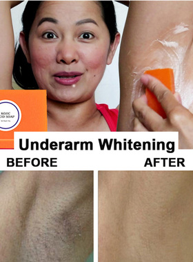 KojicAdHandmeWhitgS