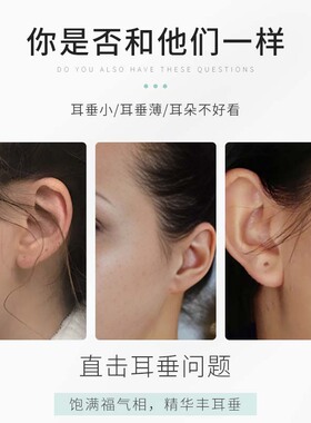 【耳朵小变大】丰耳垂药水