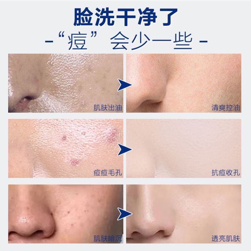 御泥坊男士竹炭御men控油洗面奶 Fcren男士洁面