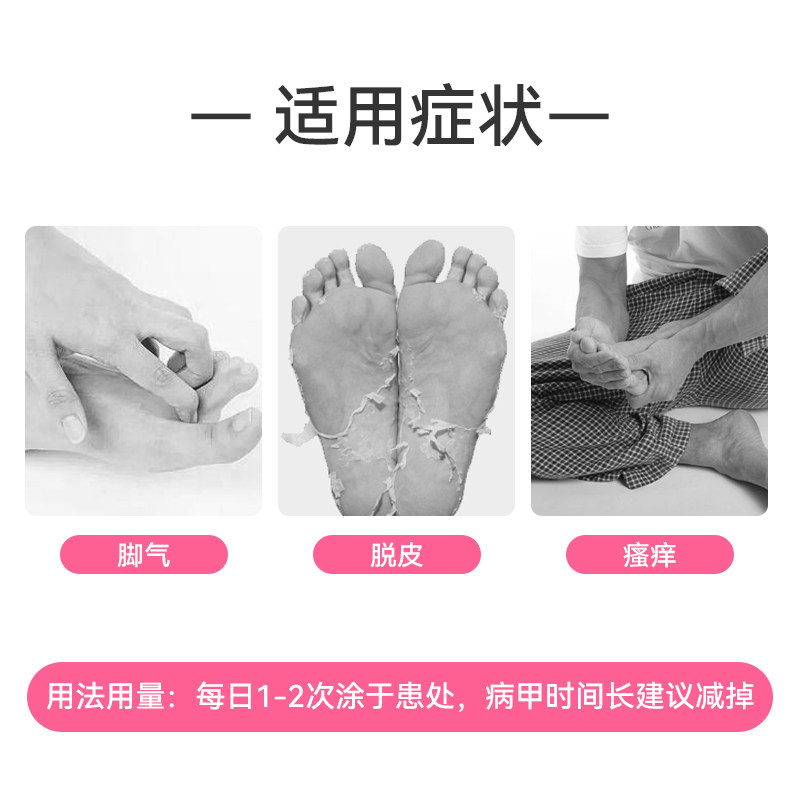 小林制药脚气真菌水日本脱皮脚气膏 瑞欧佰药海外国际皮肤科药品