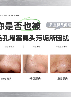 natural beauty/自然美洁净黑头鼻膜
