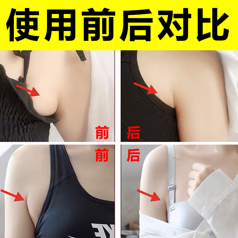 副乳消除贴【用过的都推荐】去副乳克星腋下淋巴疏通矫正专用药贴 - 图1