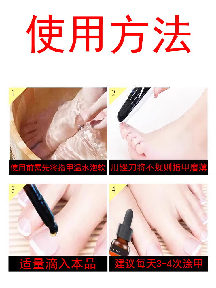 【买2送1 买5送5】云南红药草本灰甲保健液抑菌液指甲外用15ml - 图2