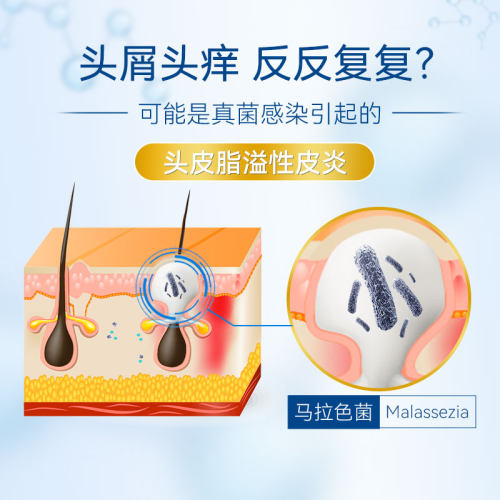 滇虹康王酮康唑洗剂洗发水去屑止痒脂溢性皮炎头皮屑酮康挫旗舰店 - 图1