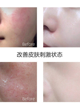 博禾舒缓护肤霜改善皮肤刺激30克