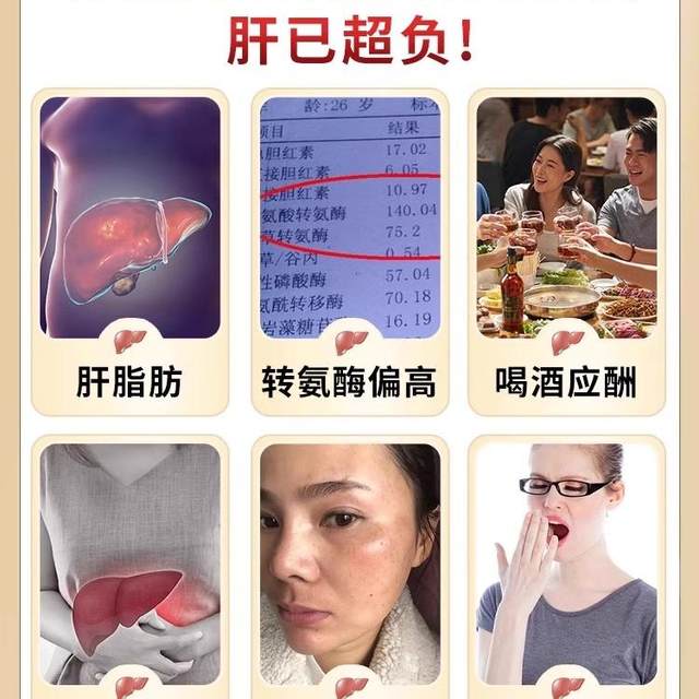 Upgraded version of liquid liver gold imported from the United States. Stay up late and drink milk thistle. Protect your liver. Official authentic product.