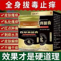 (Official) Heckling of Herbal Cream Cream for Herbal Cream Wash of hand allergy skin pruritus Eczema Dermatitis Urticaria
