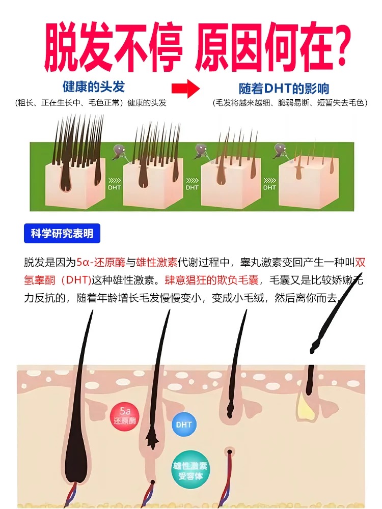 男士脱发严重男专用dht阻滞剂断植物非那雄胺片脂溢性防掉头发 - 图0