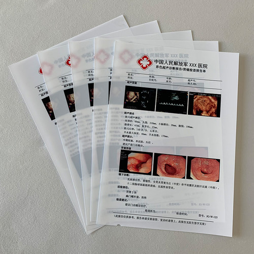 A4彩超胶片纸白色激光胶片双面打印胶片纸B超胶片纸白色激光胶片-图3