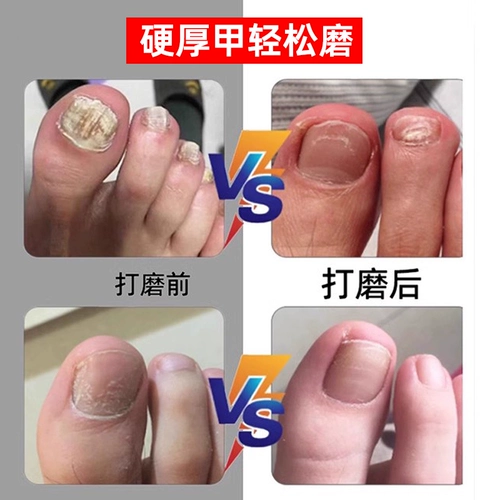 Электрическая броня резака