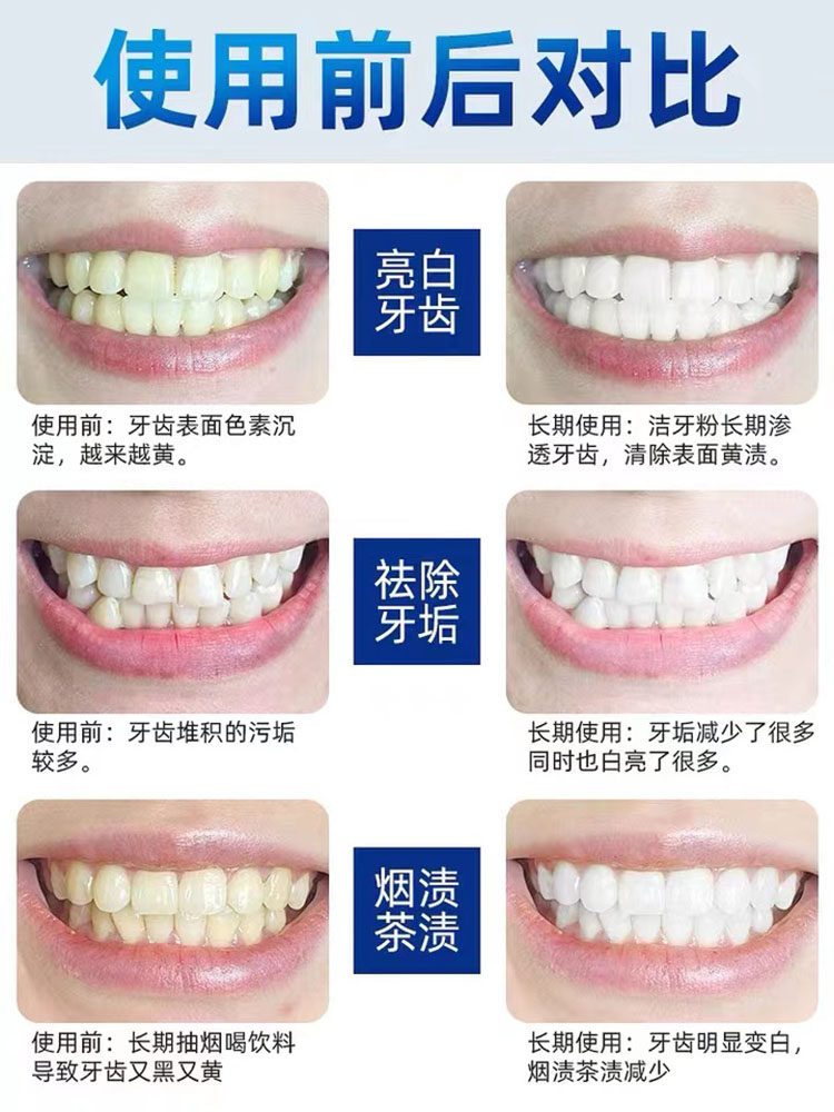 俏代美美白牙粉 丹颜兰品牙粉