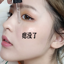 Kuchens this years very fire unscabled where its not a net point to remove the cut black spot spots on the face.