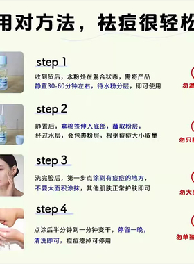ZUZU精准祛痘精华液3.0雪大推荐学生淡化清颜祛痘去淡化痘印瘪痘