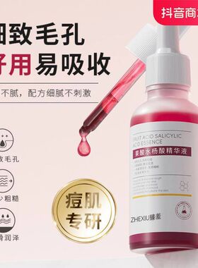 正品臻羞果酸水杨酸精华液收缩毛孔粗大修护精华液面部补水嫩细滑