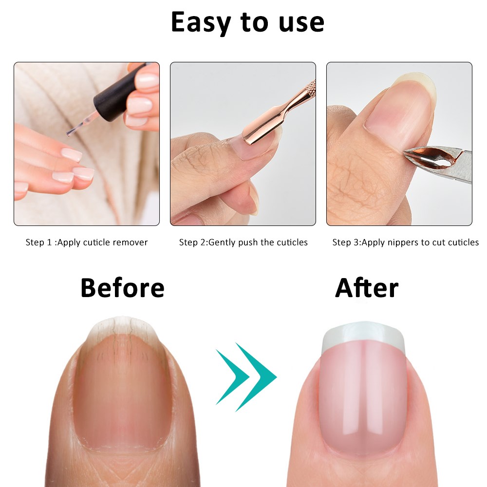 Toenail Toe Ingrown Nail Art Cuticle Nipper Clipper Edge Cut-图3