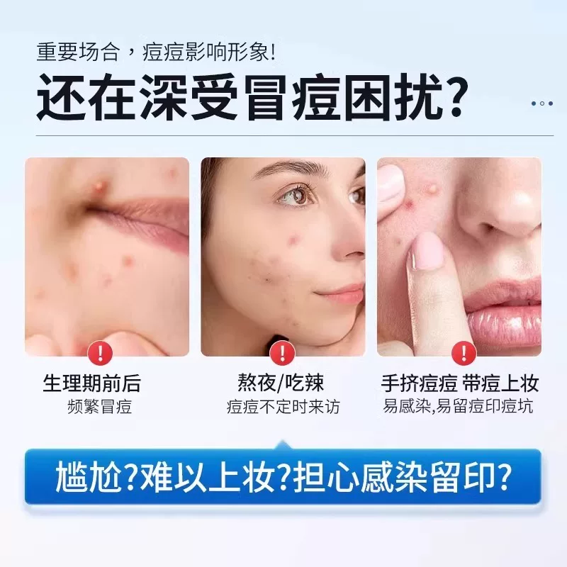 Acne patch, cute foundation, conceals acne, anti-acne