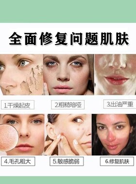 官方正品汉香面膜酵母精华调配酵素肌能修颜保湿旗舰店(四盒装）