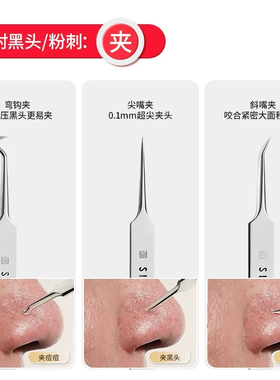 张小泉高精密粉刺夹抗菌细胞夹去黑头粉刺针超尖专业级美容院专用