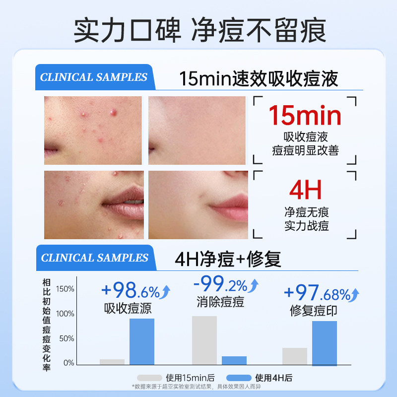 医用痘痘贴人工皮修复消炎吸脓祛痘印隐形薄遮瑕可上妆水胶体72贴,淘宝优惠券,粉丝福利购,淘宝优惠卷