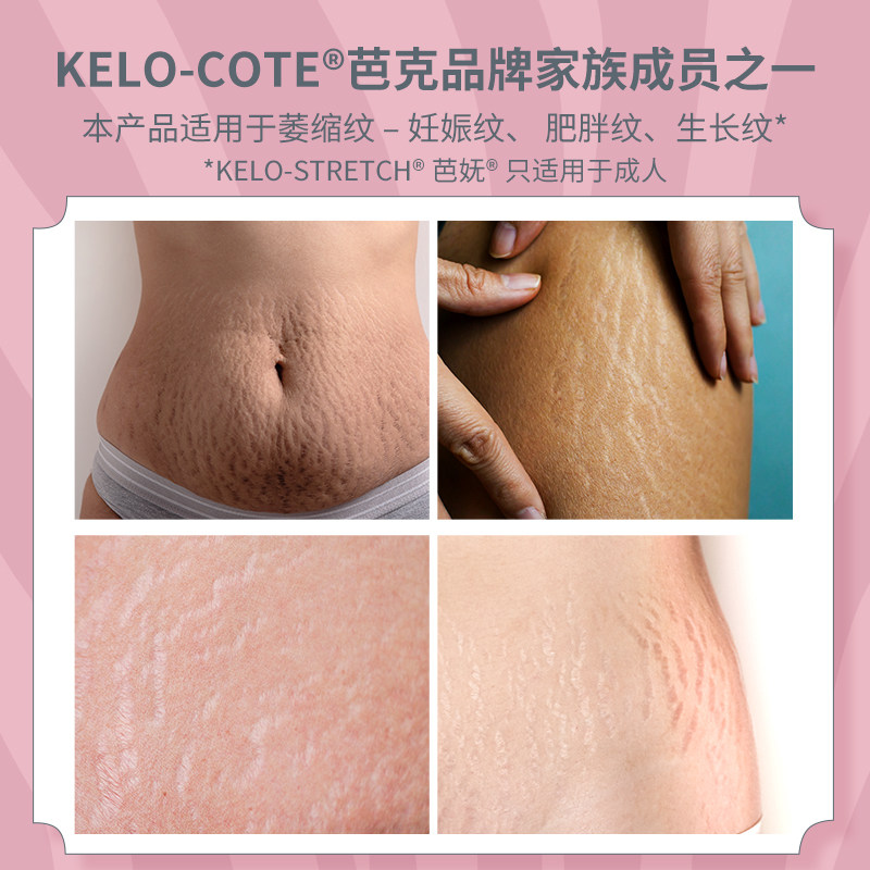 正品kelo-stretch芭妩妊娠纹身体乳 Alliance海外身体乳/霜
